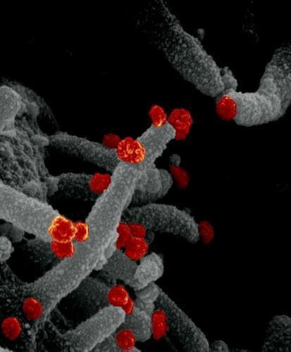 배양 세포 표면에서 빠져나오는 신종 코로나바이러스(적색)의 주사형 전자현미경 이미지.[미국 NIAID(국립 알레르기 감염병 연구소). 재판매 및 DB 금지]